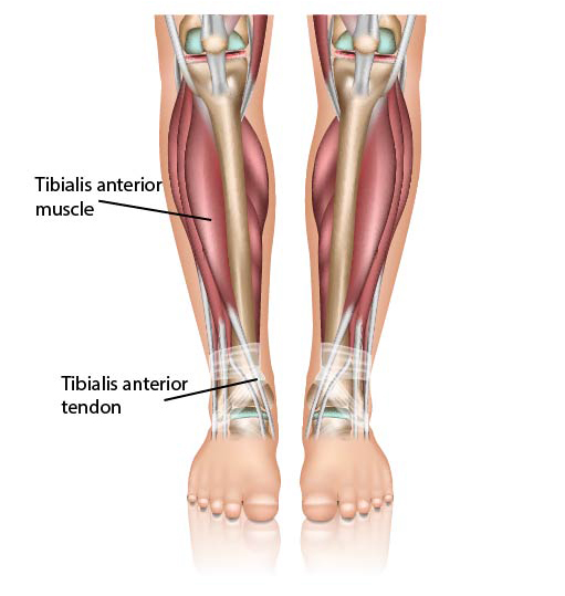 anterior-tibialis-tendonitis.jpg