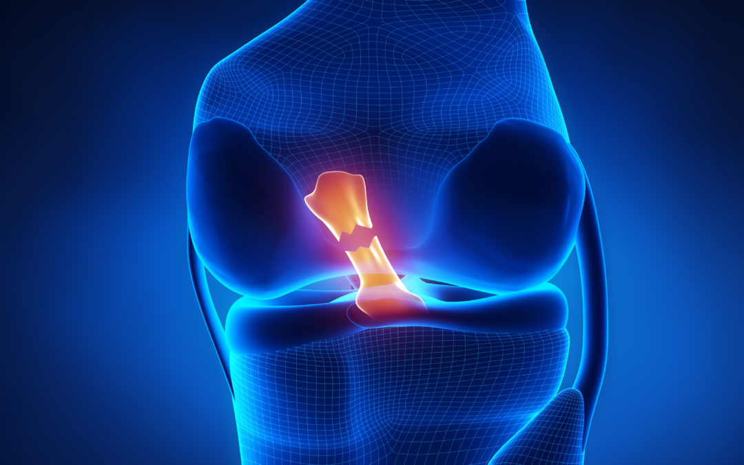 Acl Reconstruction Surgery Graft Choices The Center Acl Reconstruction Surgery Graft Choices The Center