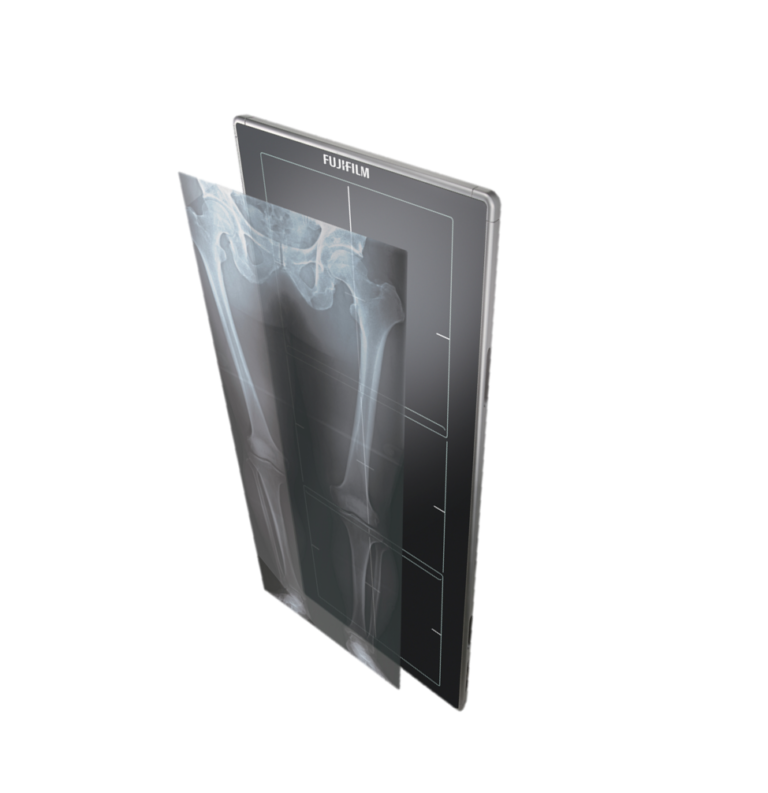 Digital Xray Long Length Detector The Center