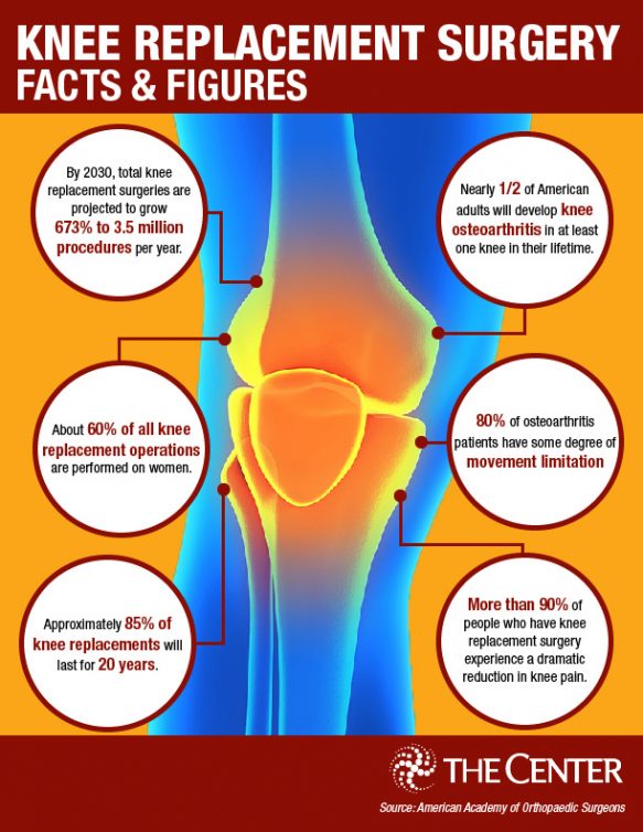 Knee Replacement Surgery By The Numbers The Center