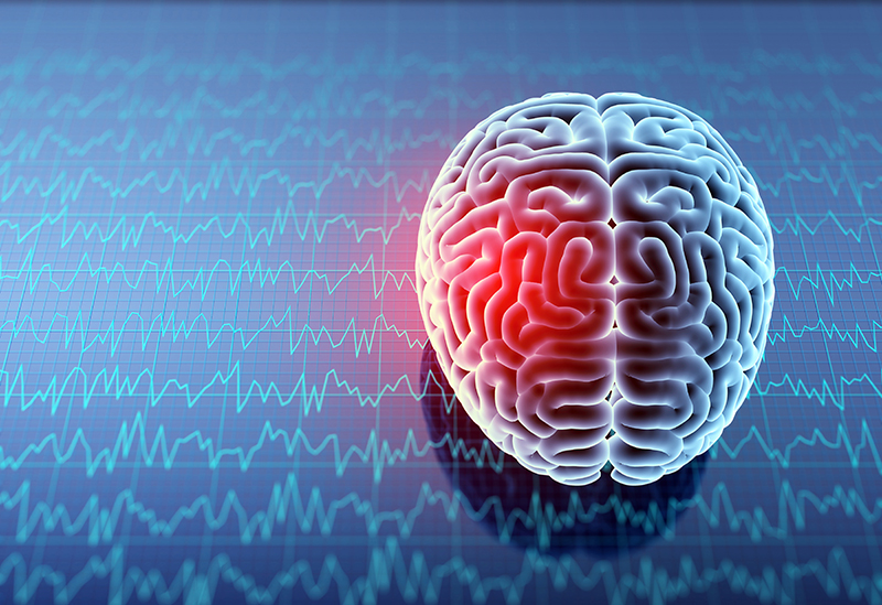 Concussion Systems Concussion Treatment The Center concussion-systems-concussion-treatment-the-center
