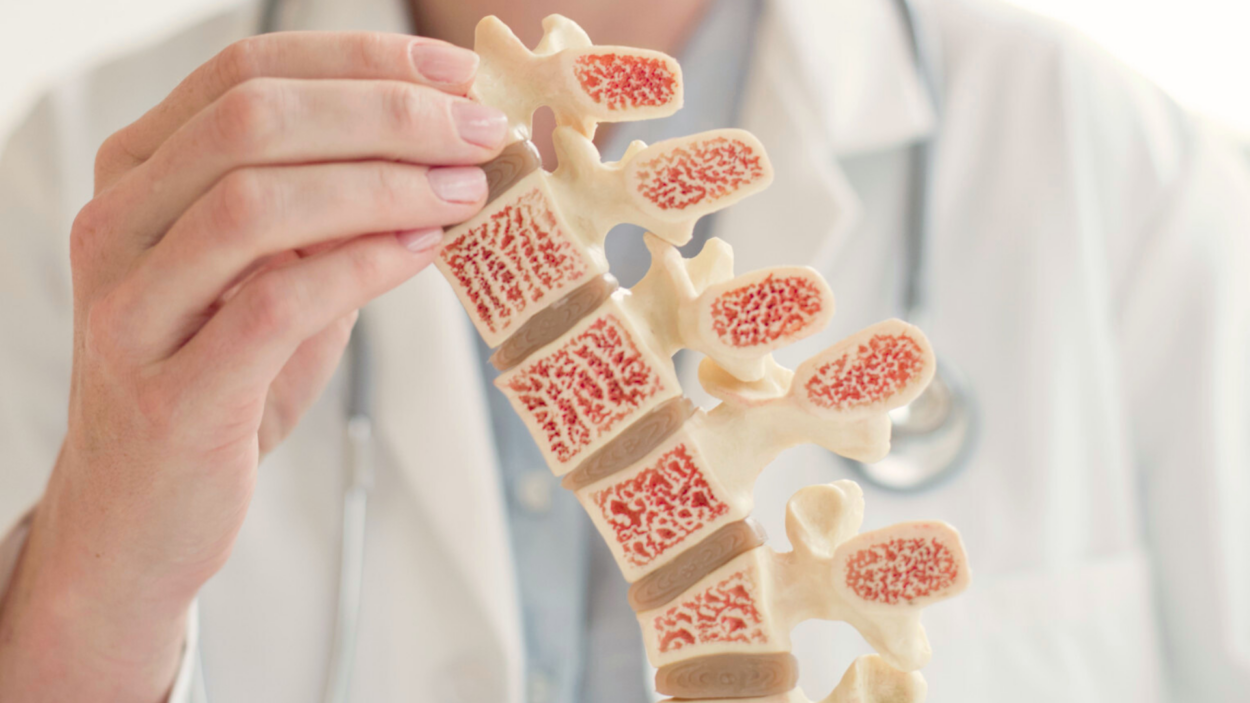 Doctor holding anatomical model of human spine with osteoporosis.